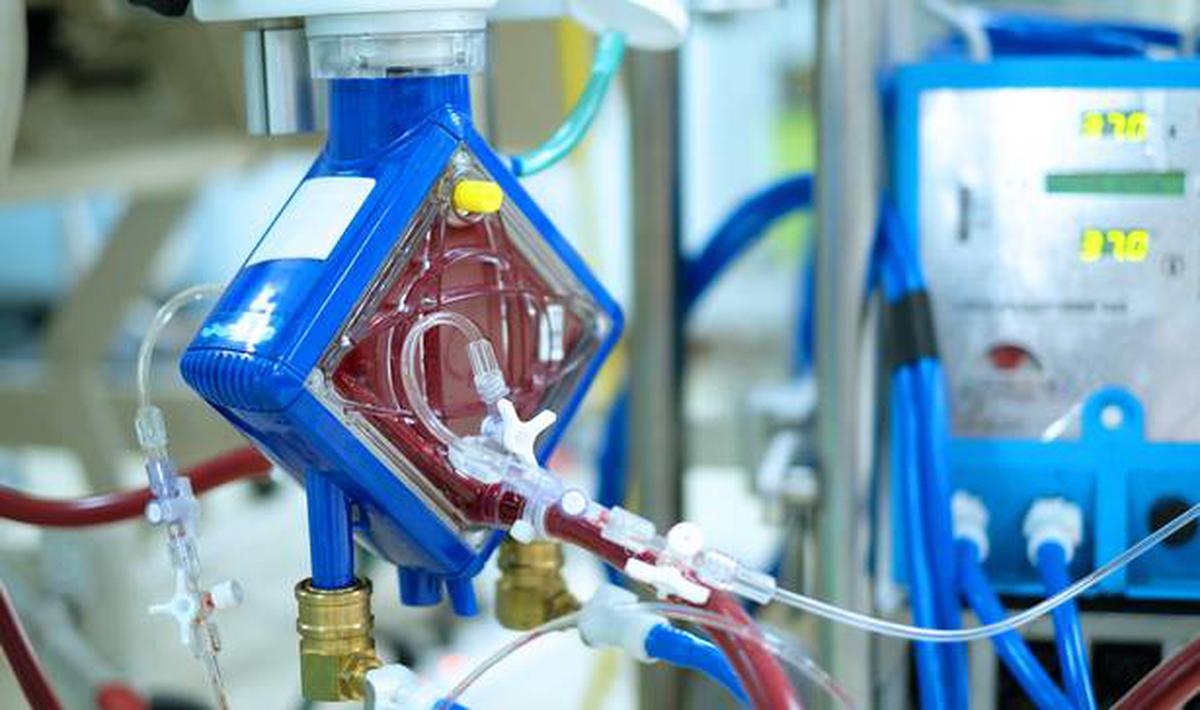 ECMO turns a lifesaver for children with heart and lung problems