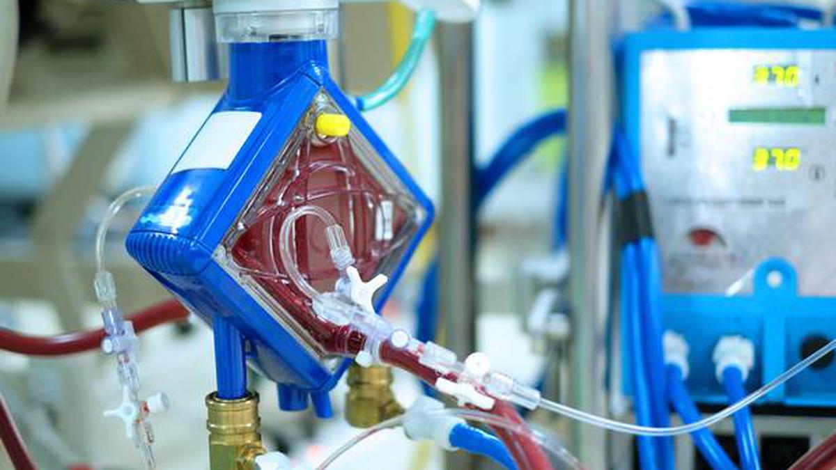 ECMO Therapy: An Advanced Form of Treatment For Very Sick Children ...