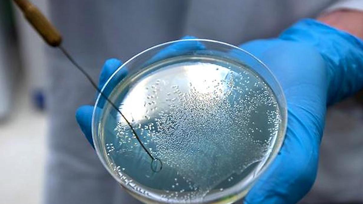 CDC warns of drug-resistant salmonella infections linked to backyard poultry