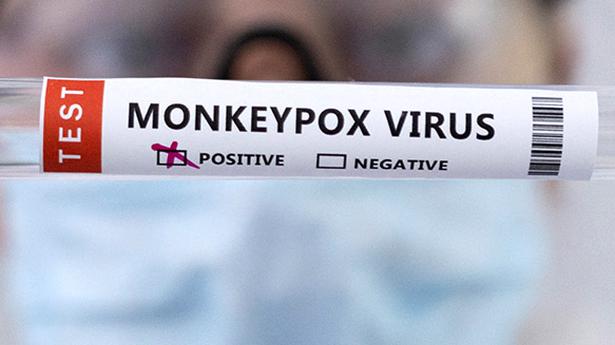 Ethiopian national with monkeypox symptoms quarantined in Karnataka; test reports awaited