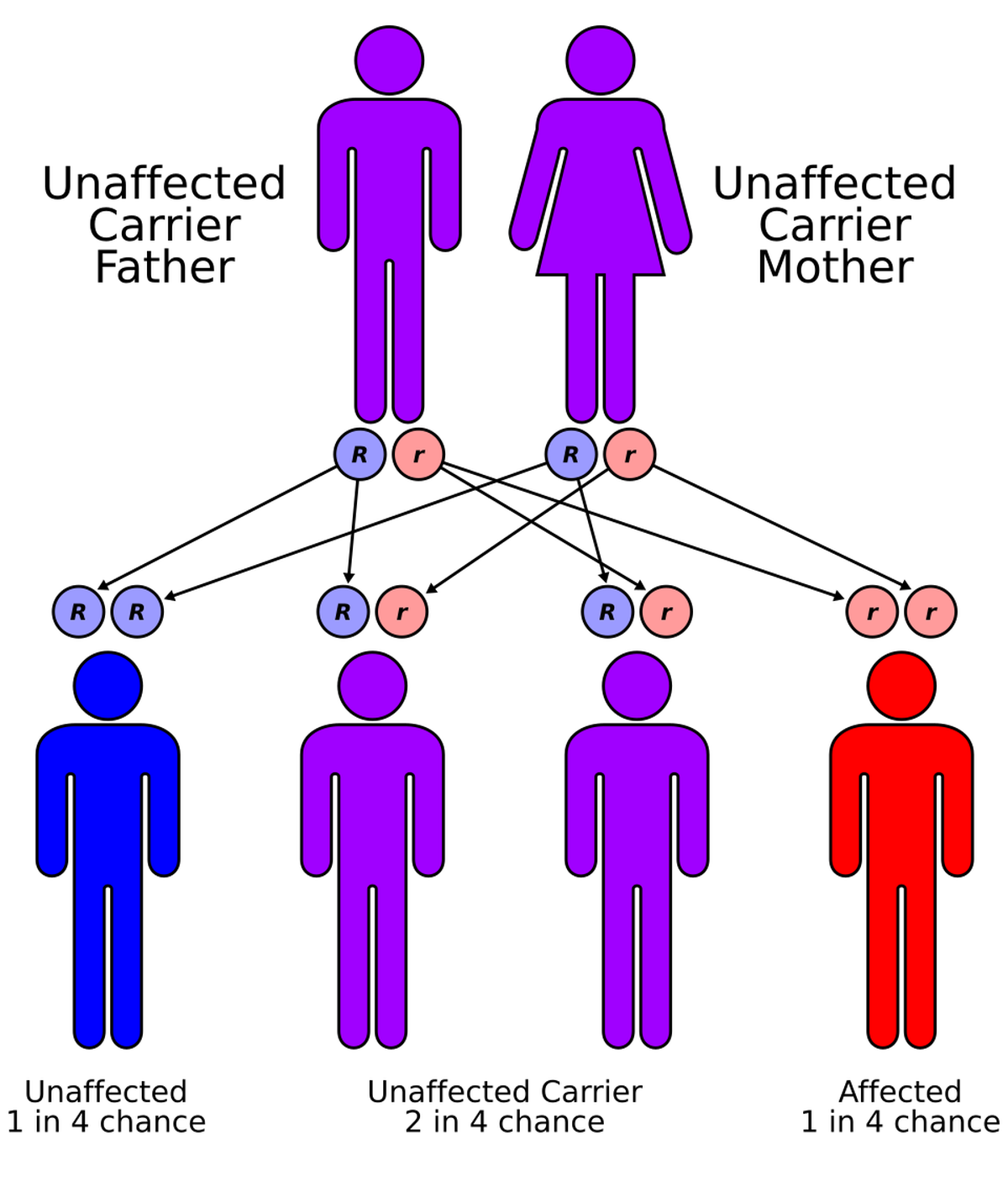 Lafora disease is inherited in an autosomal recessive manner. This means that a person must inherit two faulty copies of a gene — one from each parent — to develop the disease Lafora disease is inherited in an autosomal recessive manner. This means that a person must inherit two faulty copies of a gene — one from each parent — to develop the disease