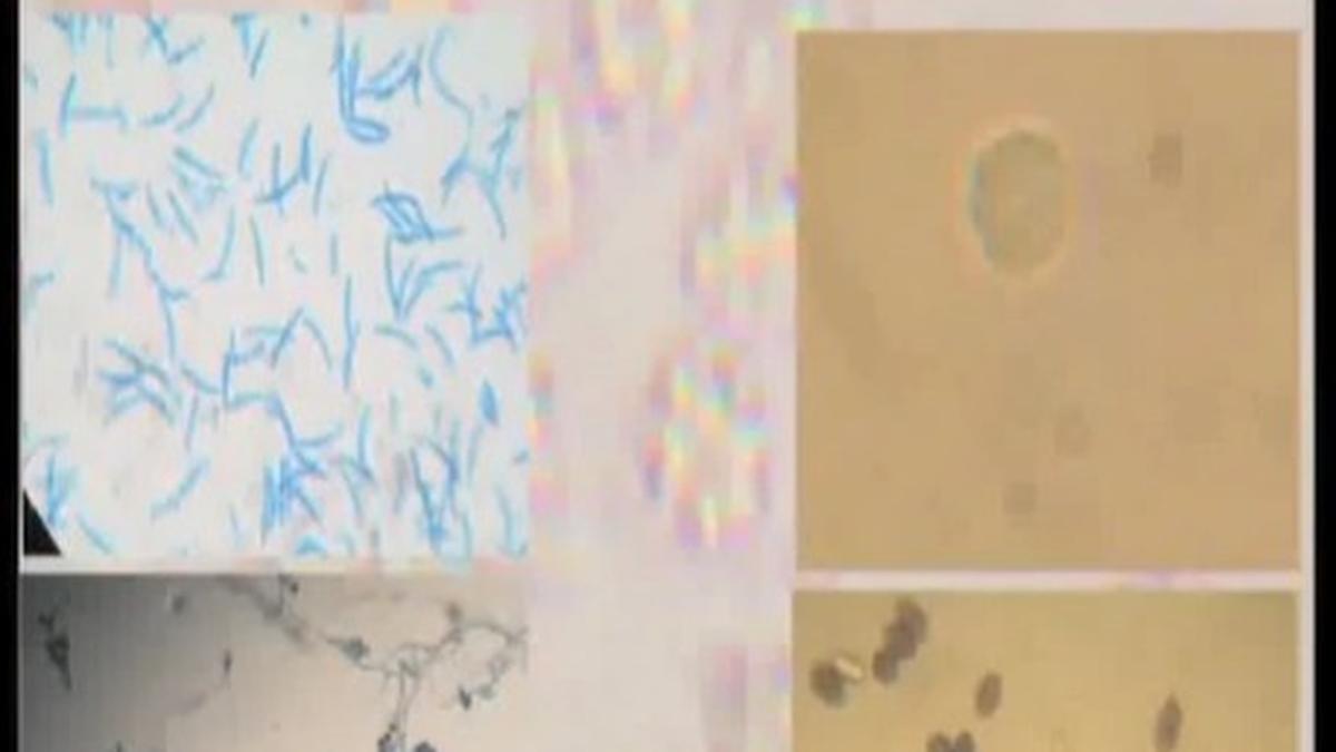 Acanthamoeba more widespread in Kerala’s waterbodies than thought earlier