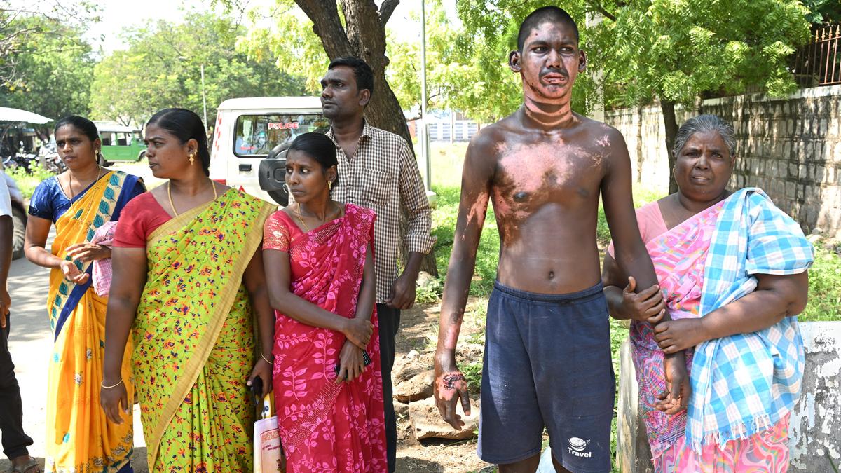 Petrol bomb attack victim seeks medical assistance, aid to bail-out family