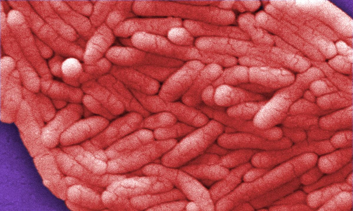 Under a very high magnification of 12000X, this scanning electron micrograph shows a large grouping of Salmonella bacteria.