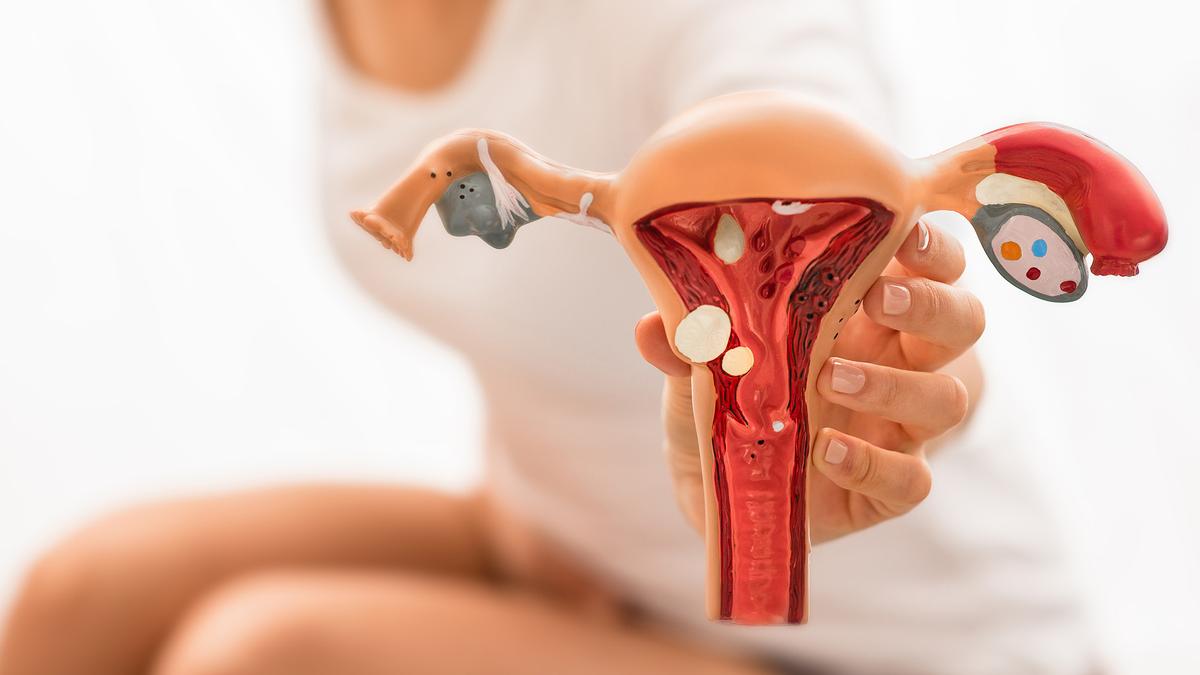 Ovary insufficiency linked to higher chances of autoimmune disorder: study