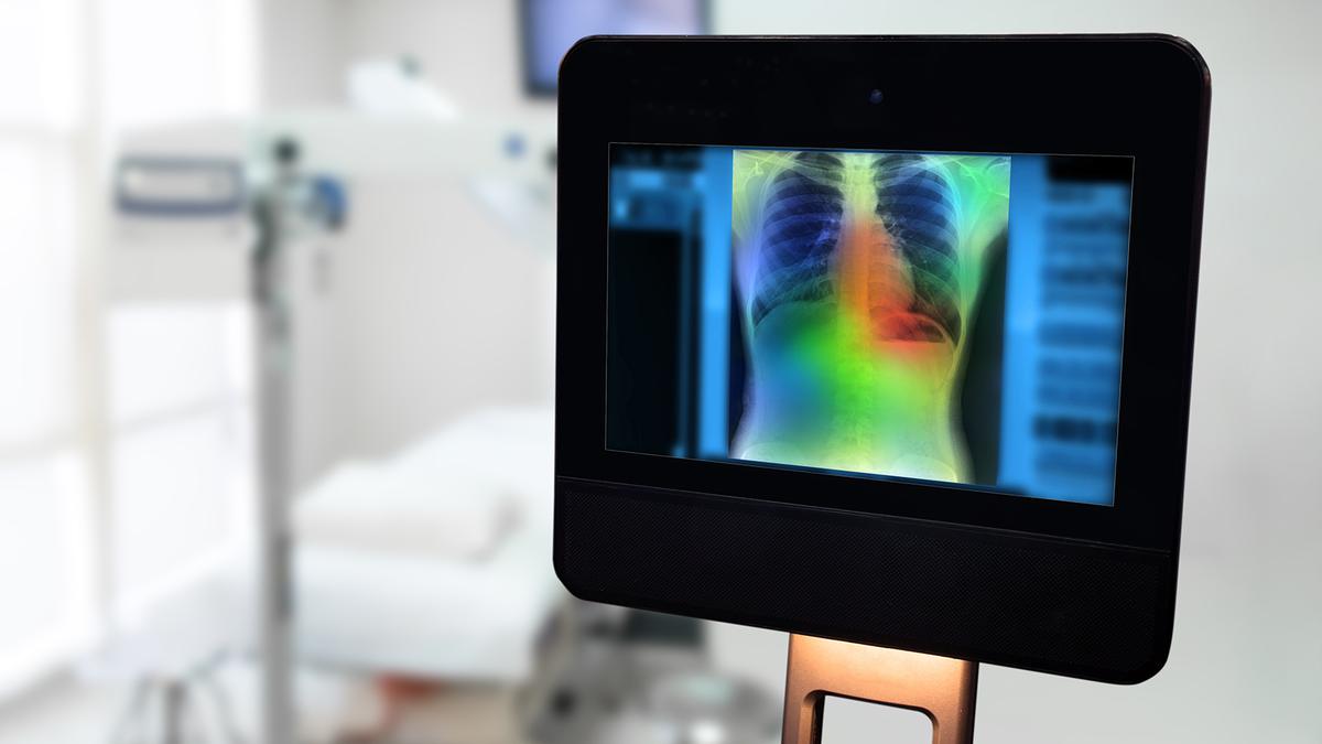 Can AI really replace radiologists?