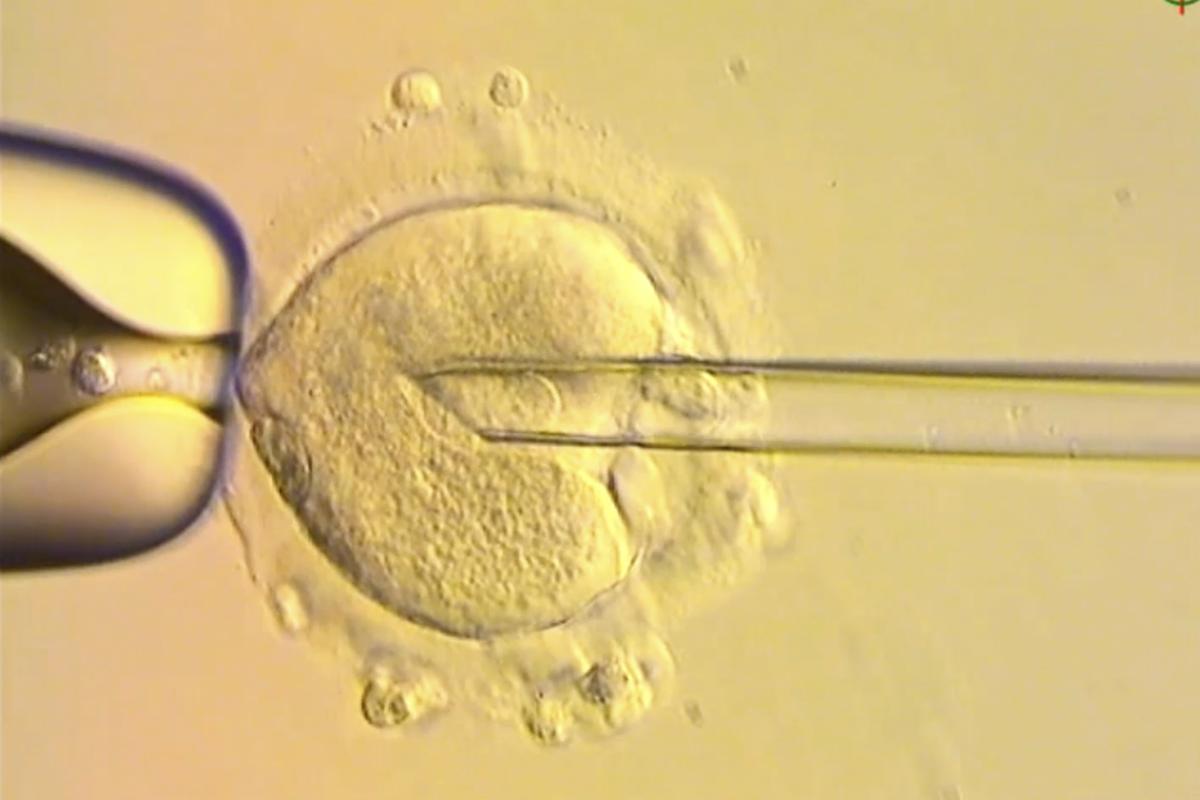 This image from video provided by the Newcastle Fertility Centre shows a nuclear genome from an egg carrying a mitochondrial DNA mutation being inserted into an egg donated by an unaffected woman. This image from video provided by the Newcastle Fertility Centre shows a nuclear genome from an egg carrying a mitochondrial DNA mutation being inserted into an egg donated by an unaffected woman.