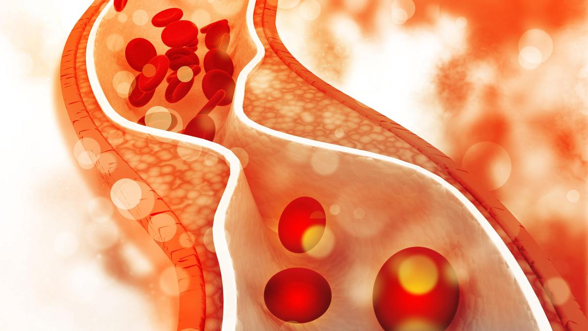Life-saving numbers: what the 2026 U.S. cholesterol guidelines mean for everyone