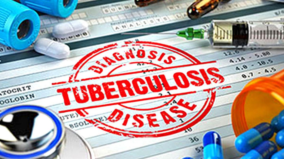 Study finds alarming financial hardship resulting from TB marring treatment programme