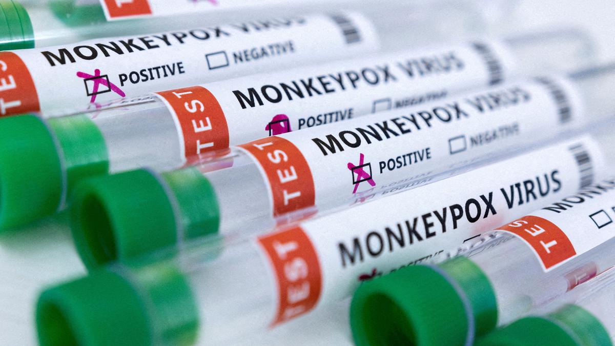 Second confirmed case of monkeypox in Delhi