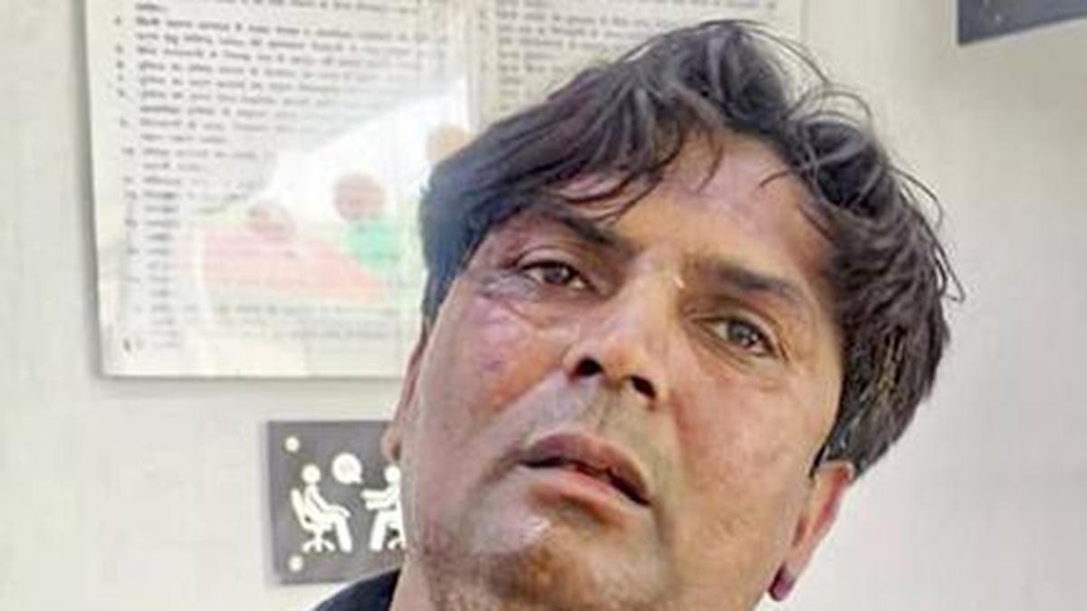 Delhi CM attack case: Court seeks report after accused allege assault, threats inside jail