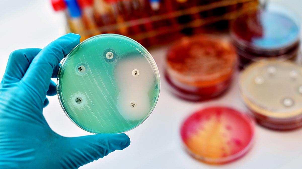 IIT Madras develops low-cost chip-based device for rapid antibiotic susceptibility testing