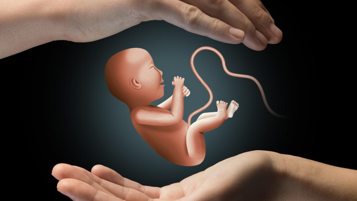 Rare congenital anomaly of of ‘foetus in fetu’ seen in Maharashtra’s Buldhana district