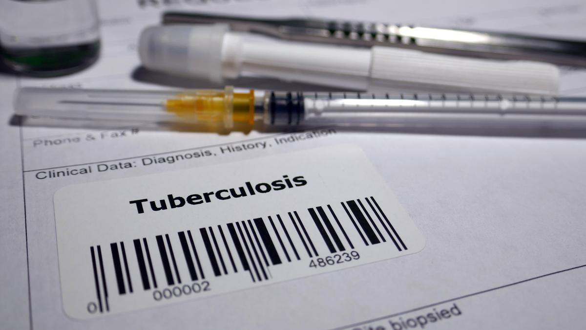 New TB vaccine for adolescents, adults ready for commercialisation