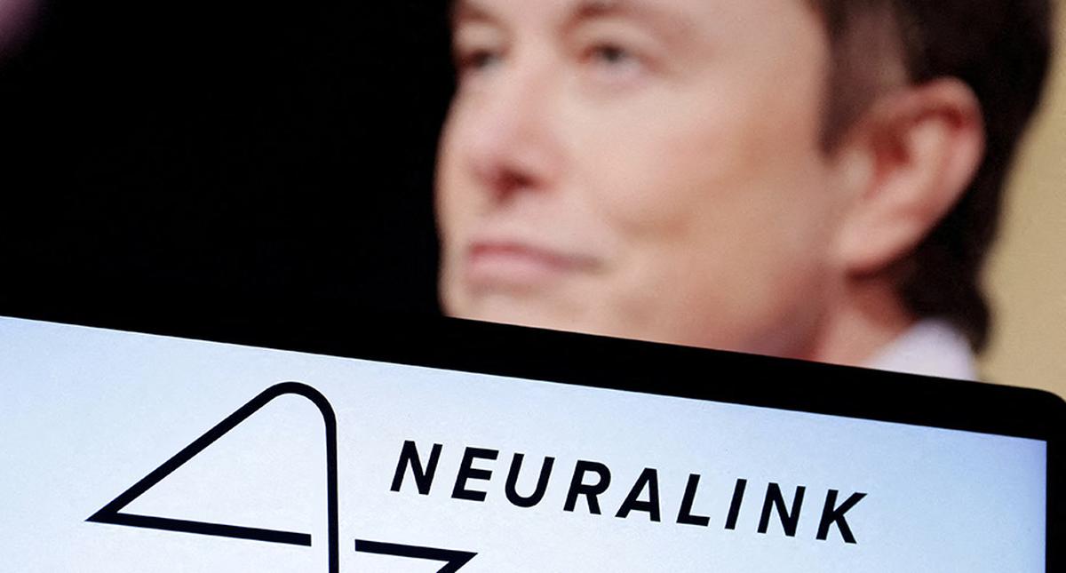 Belangrijkste feiten over Neuralink, het geautomatiseerde gokken van Musk