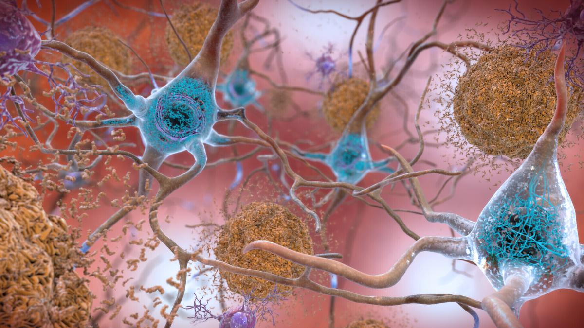 Harnessing the brain’s immune cells to stave off Alzheimer’s diseases