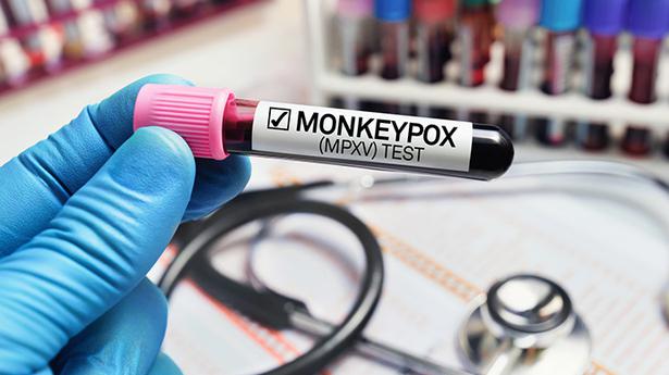 Monkeypox peut causer des dommages neurologiques, y compris une inflammation du cerveau : étude