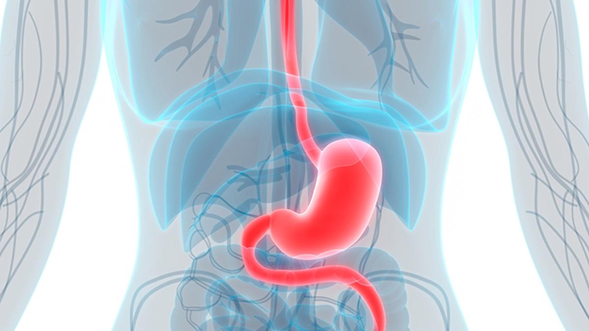 Study projects over 15 million people born during 2008-2017 could develop gastric cancer in life Study projects over 15 million people born during 2008-2017 could develop gastric cancer in life
