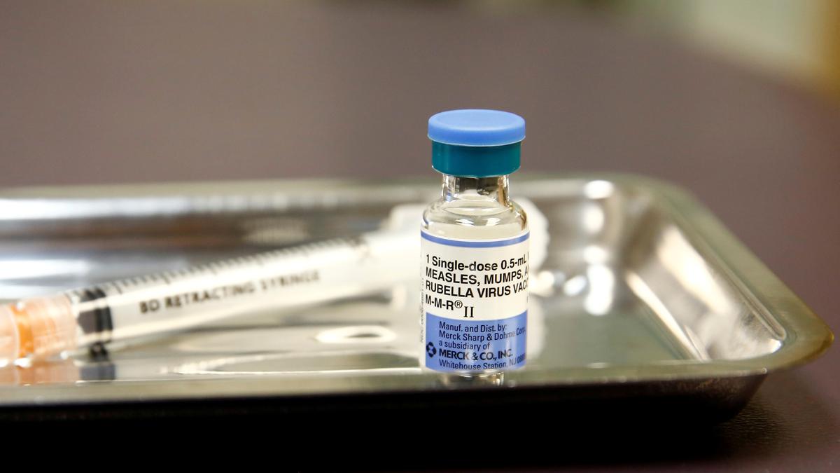 One year old died of measles in Mumbai