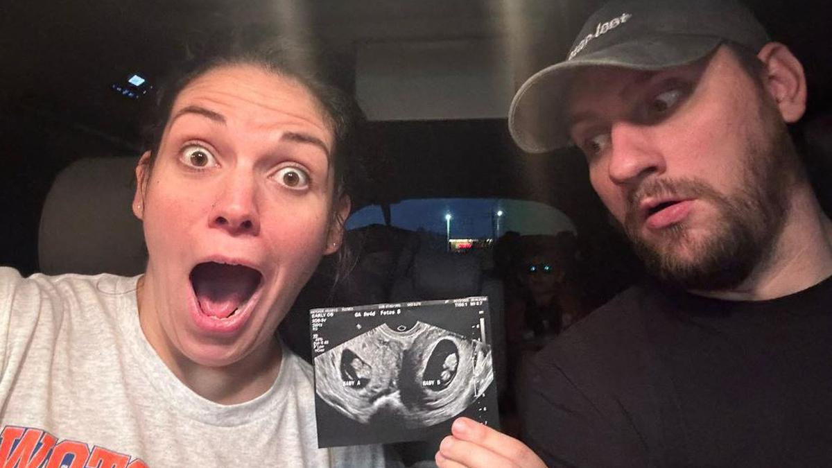 U.S. woman with rare double uterus expecting babies in both