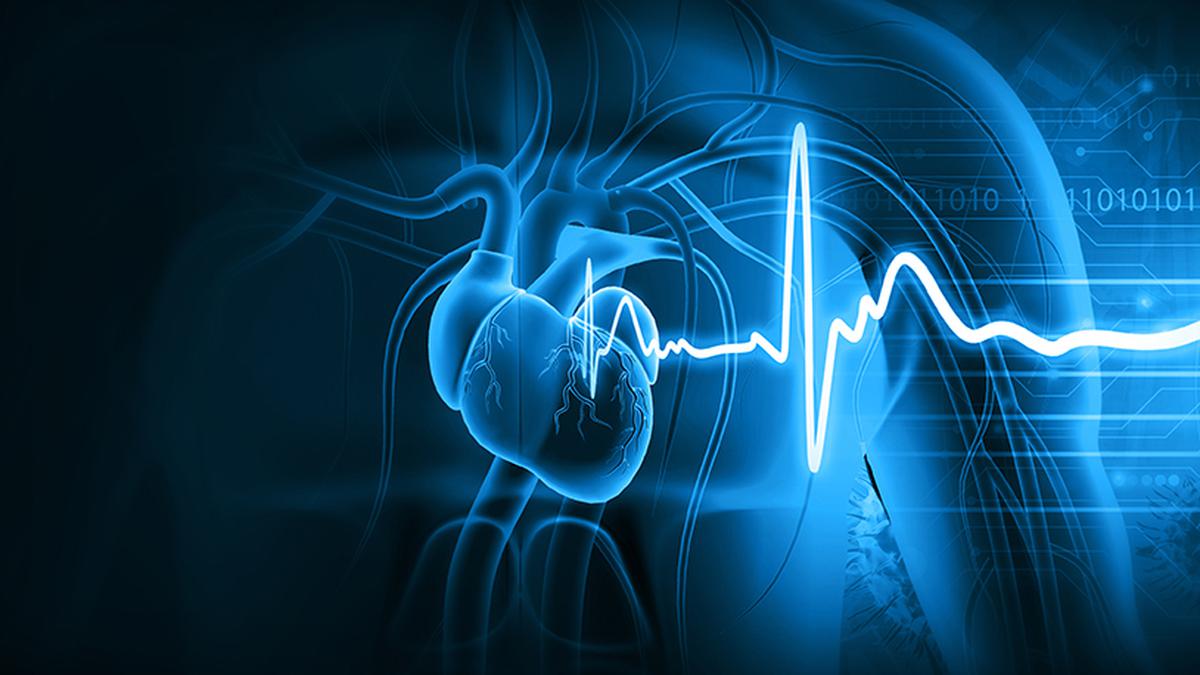 Percentage of deaths caused by heart attack declining in Kerala - The Hindu