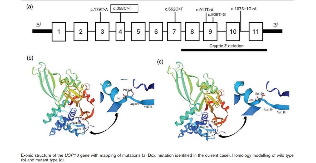 Exonic structure of the USP18 gene with mapping of mutations a) Box: mutation identified in the current case. Homology modelling of wild type (b) and mutant type (c).