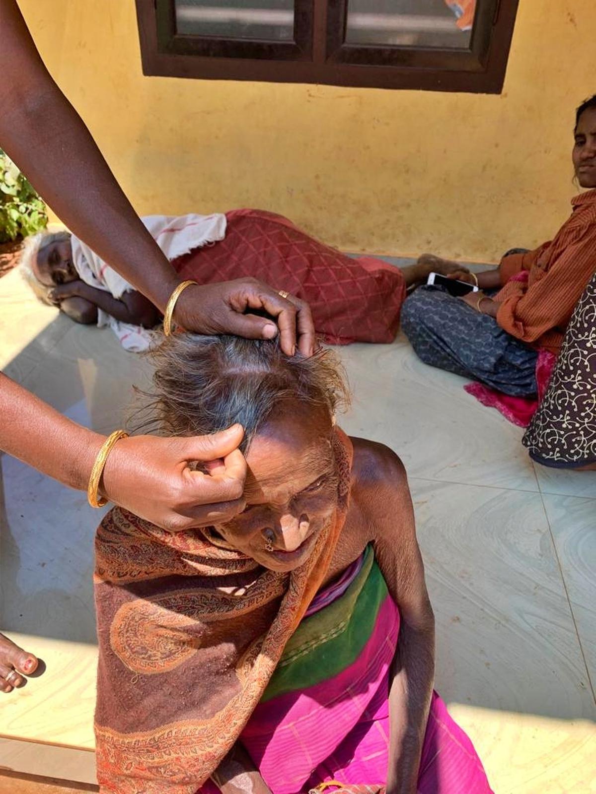 Mathi a tribal woman of the Murikkilery Oorali tribal hamlet shows a scar on her head  from a wound inflicted  in a lathicharge at Muthanga.