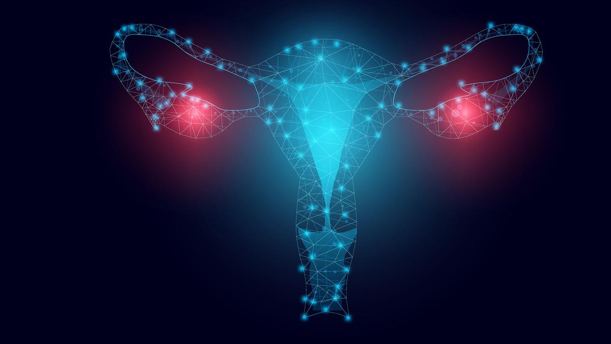 New study finds how calcium and pH regulate ovarian cancer spheroids