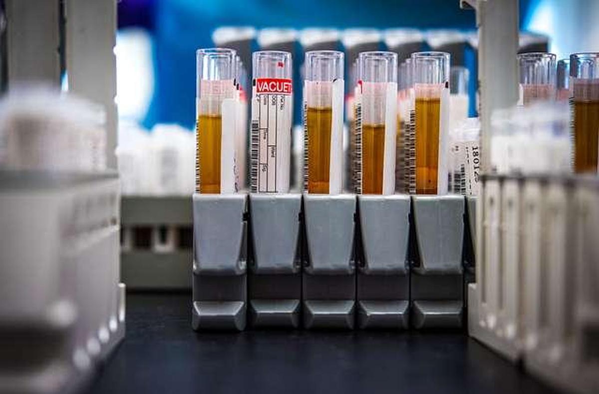 5,000 और 8,000 रक्त सीरम, मल, मूत्र, वायरल और श्वसन नमूनों का हिस्सा जो महामारी विज्ञान प्रयोगशाला सेवा में विश्लेषण के लिए सप्ताह में छह दिन पहुंचते हैं।