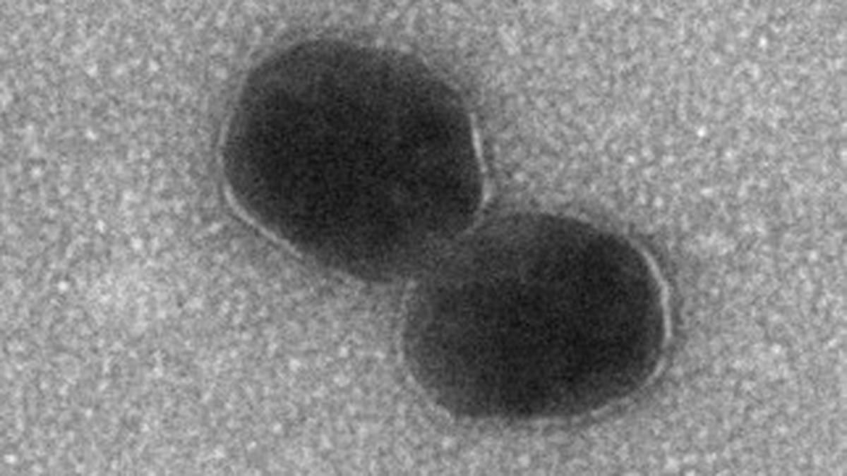 IISc scientists develop gold-coated vesicles to fight tuberculosis