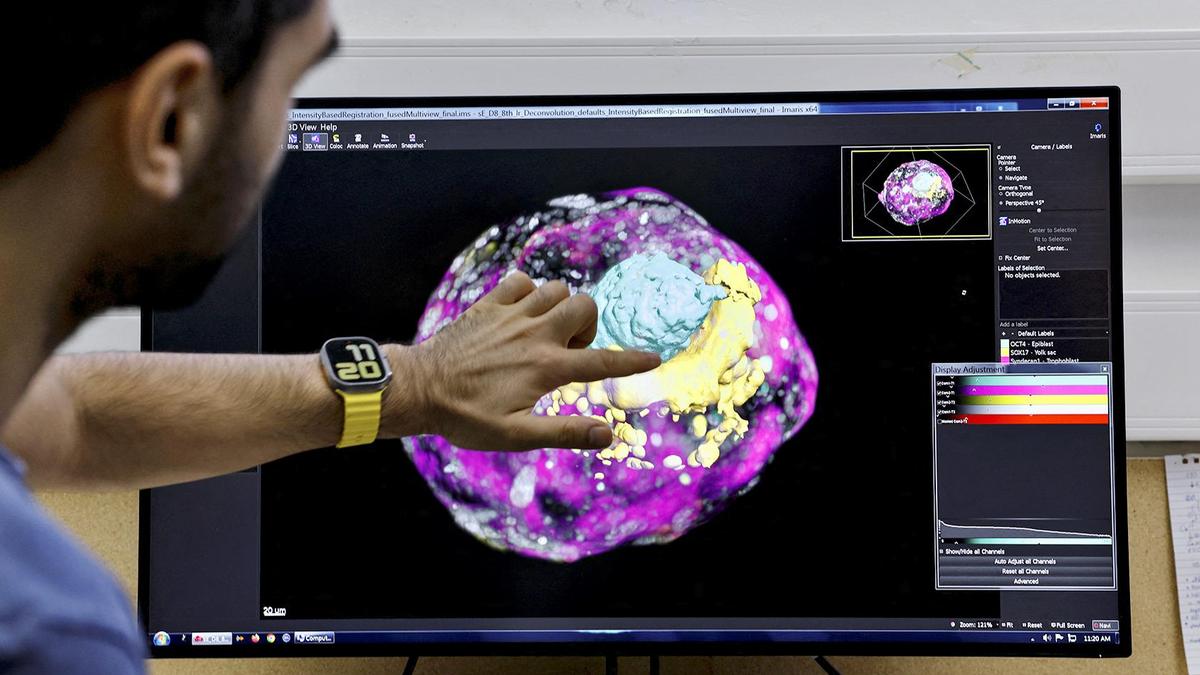 Indian scientists discover 'genetic switch' inside womb that leads to pregnancy