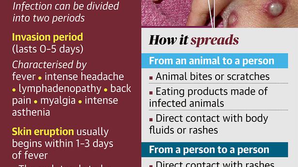 Monkeypox: all districts of Kerala put on high alert