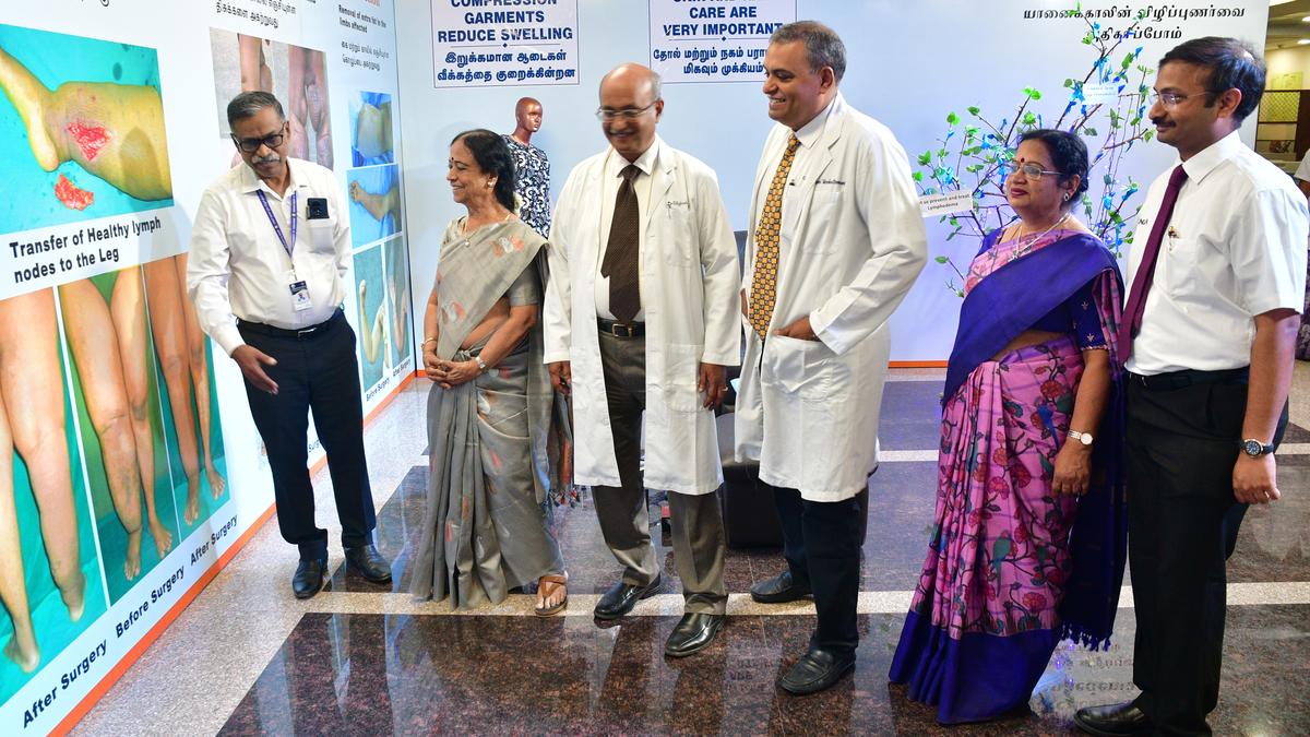 Ganga Hospital in Coimbatore creates awareness on lymphedema