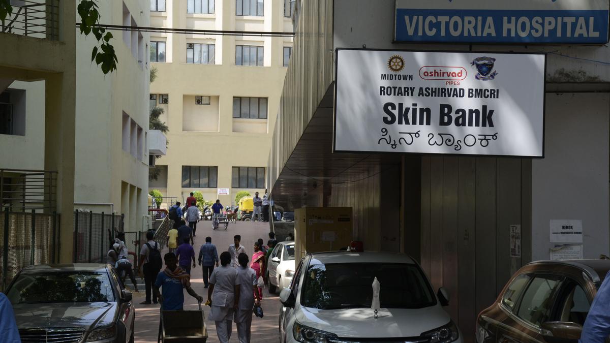 Skin donations in Bengaluru pick up but demand still outstrips supply