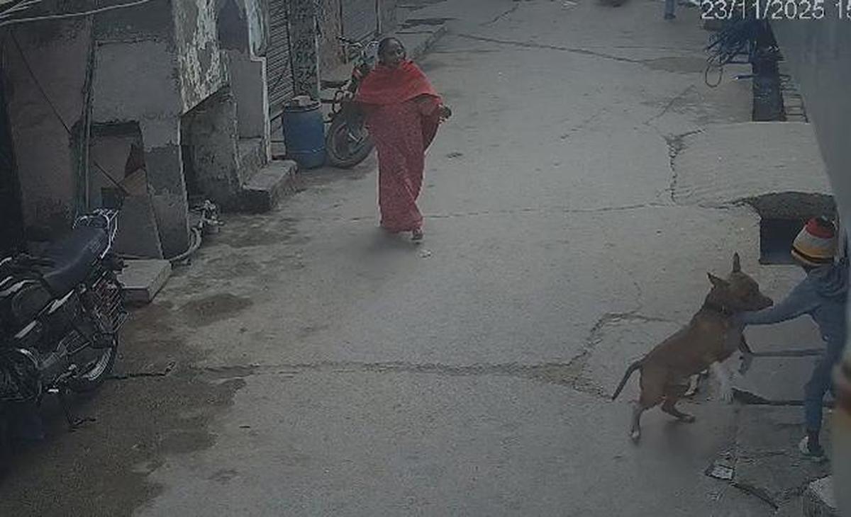 The child is receiving treatment at Safdarjung Hospital. The child is receiving treatment at Safdarjung Hospital.