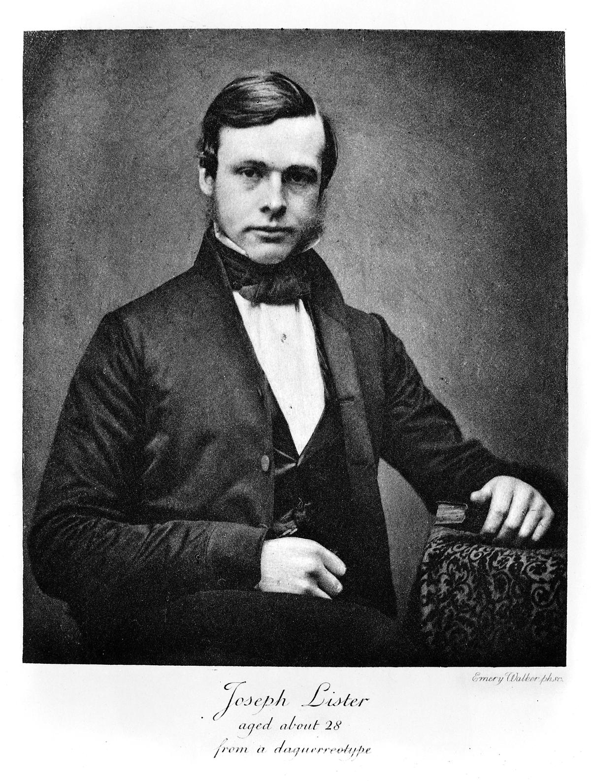 Joseph Lister, aged about 28. 