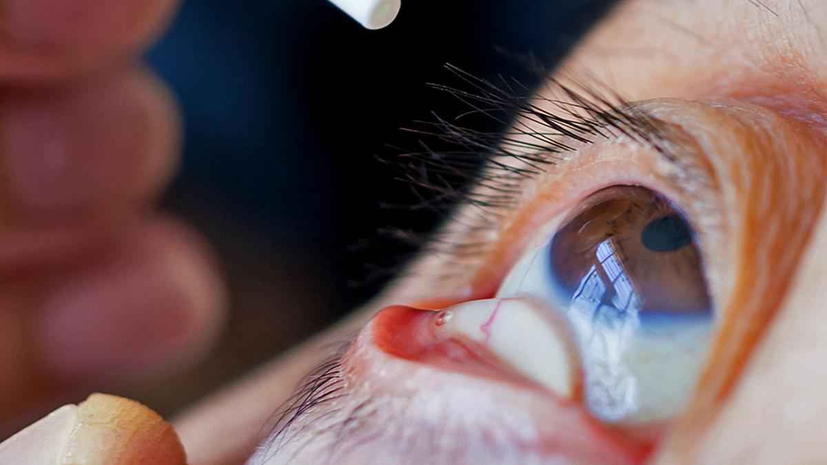 CDC concerned about drug-resistant bacteria strain allegedly linked to eye-drops imported from India