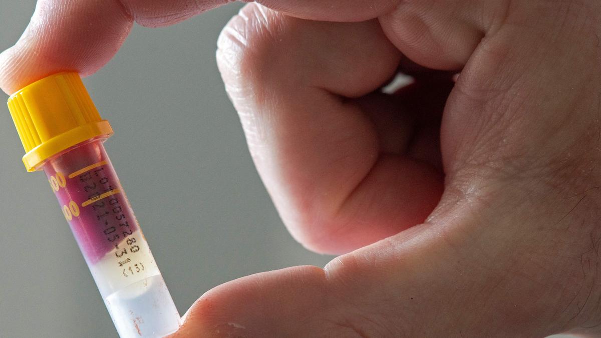 French scientists find new blood type in Guadeloupe woman French scientists find new blood type in Guadeloupe woman