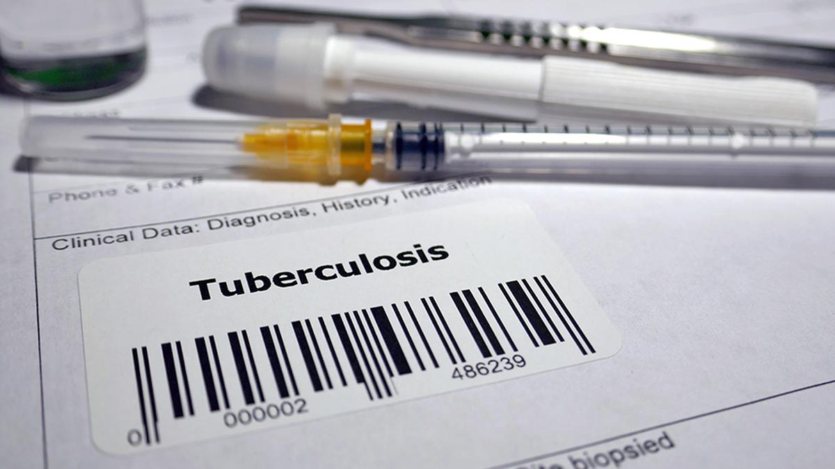 WHO calls for research scale-up towards ending TB in South-East Asia region