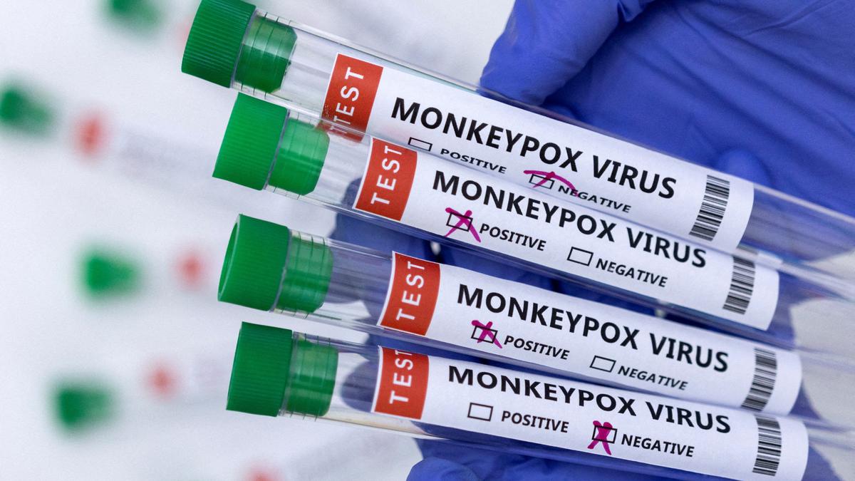 No monkeypox cases in India so far, say officials