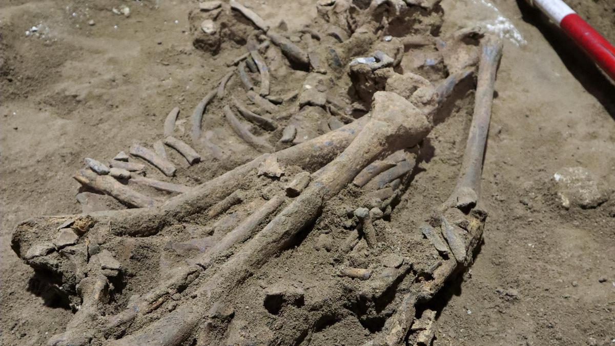 One-legged Stone Age skeleton may show oldest amputation