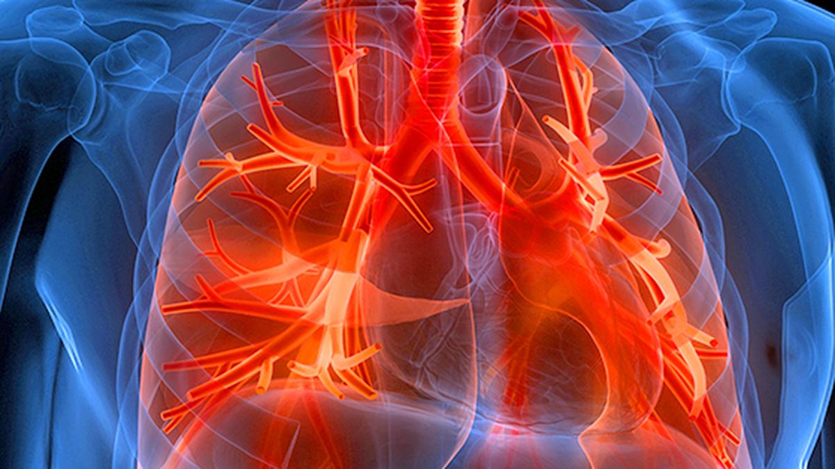 FDA Approves First Therapy for Rare Respiratory Disease; Shares Jump