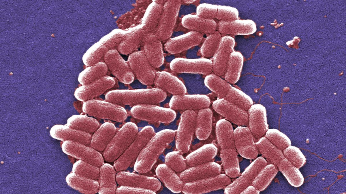 E. coli is one of the most widely studied organisms – and that may be a problem for both science and medicine
Premium