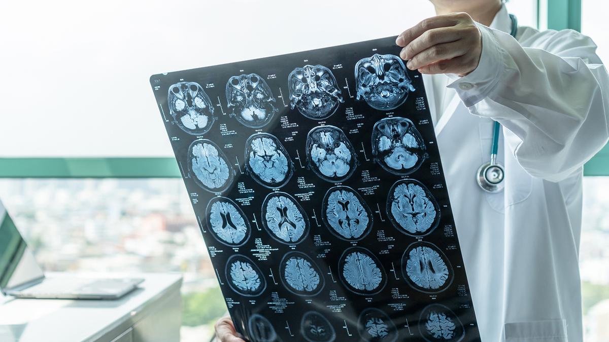 Adult Neurogenesis: Brain Cells Form Later in Life | Study Findings