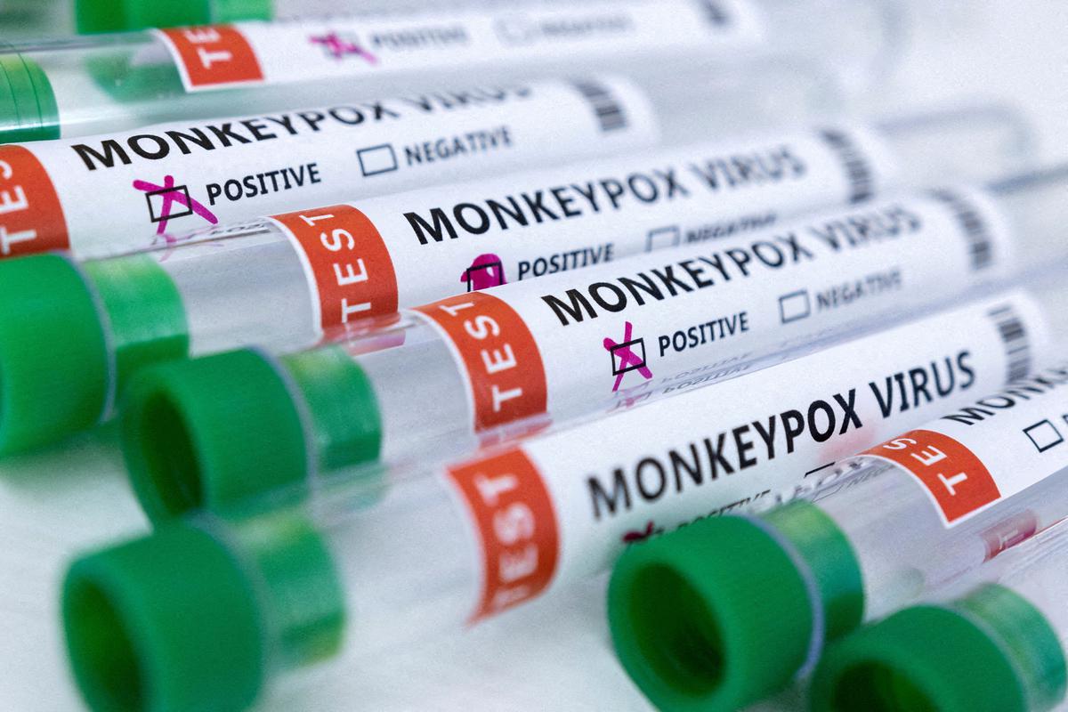 L’OMS renomme le monkeypox en mpox, invoquant des problèmes de racisme