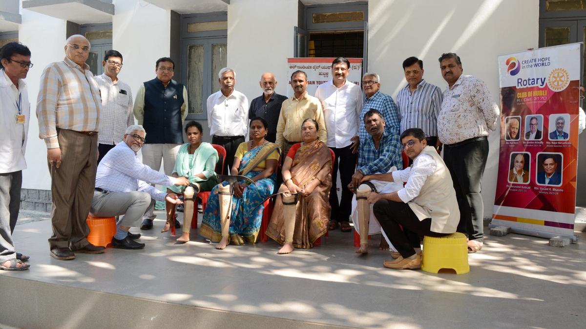 76 people get artificial limbs in Hubballi