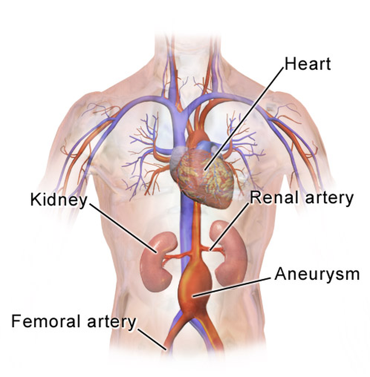 What-is-an-aortic-aneurysm-Explained-Premium