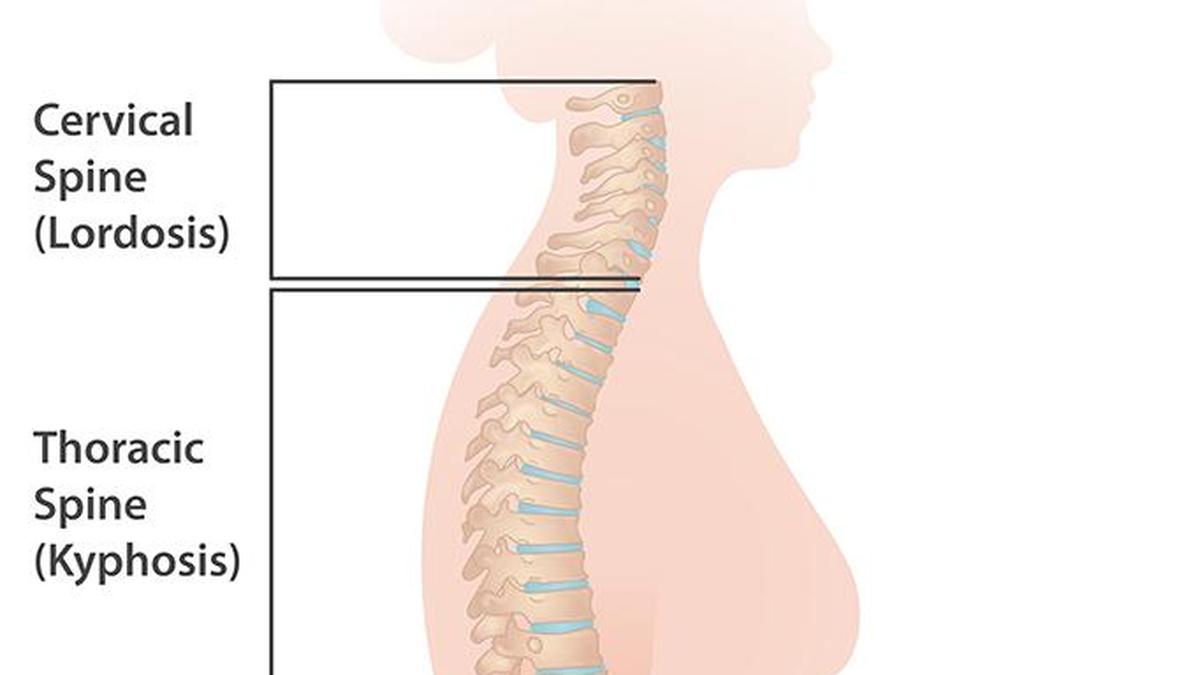 Why delaying spine surgery can lead to permanent disability