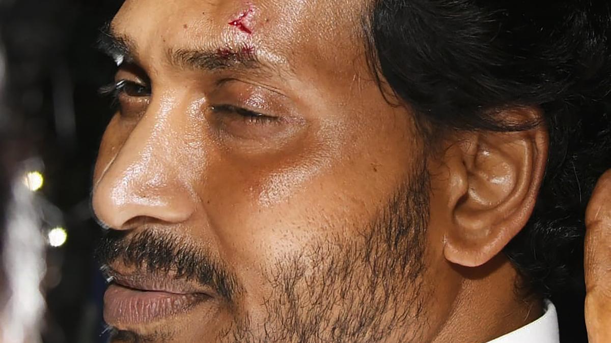 Speedy recovery wishes pour in for A.P. Chief Minister