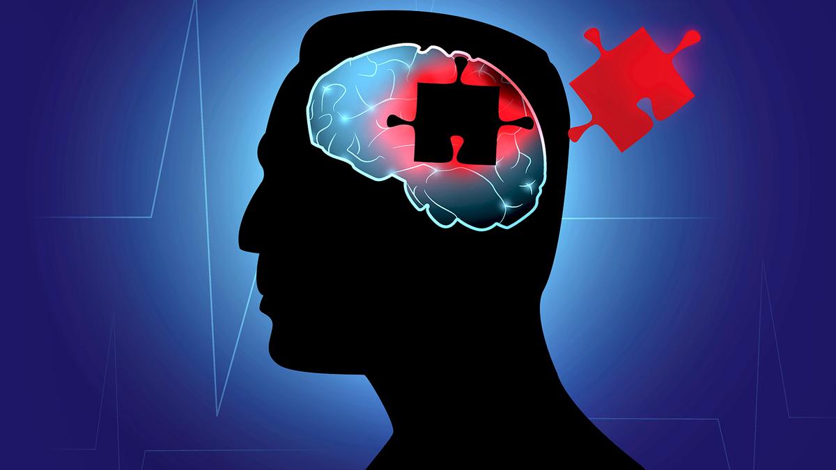 Pseudodementia: when depression masquerades as dementia